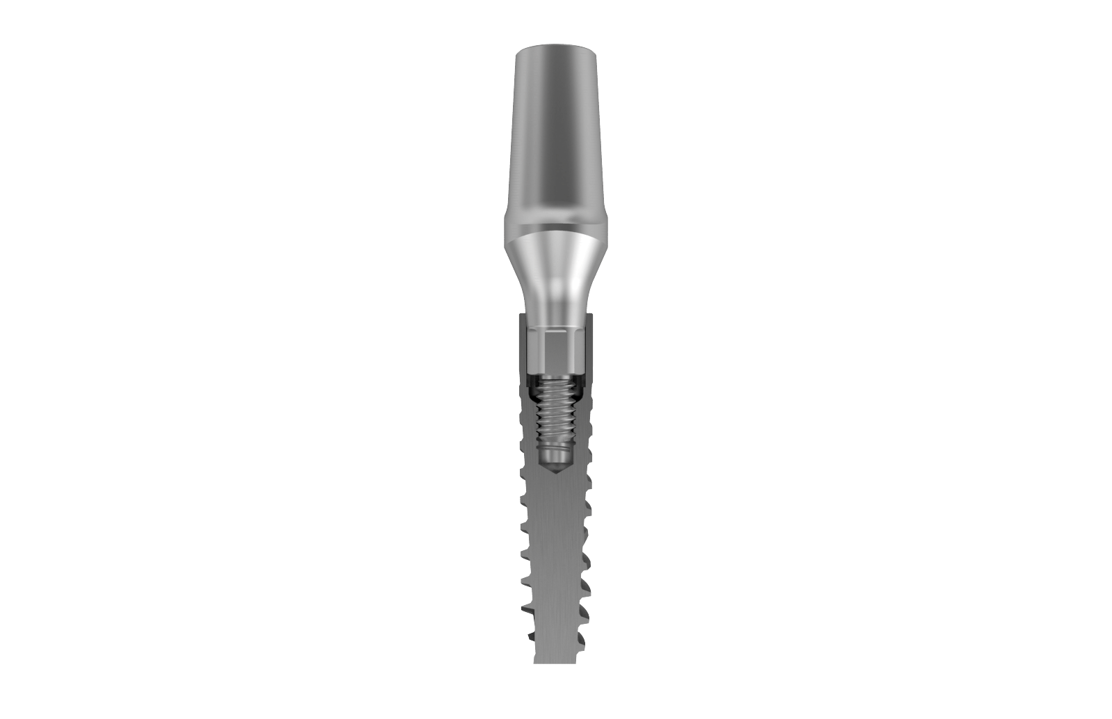 Dental Implant Design – Why Companies Are Investing Heavily in Macro, Micro and Nanotechnology