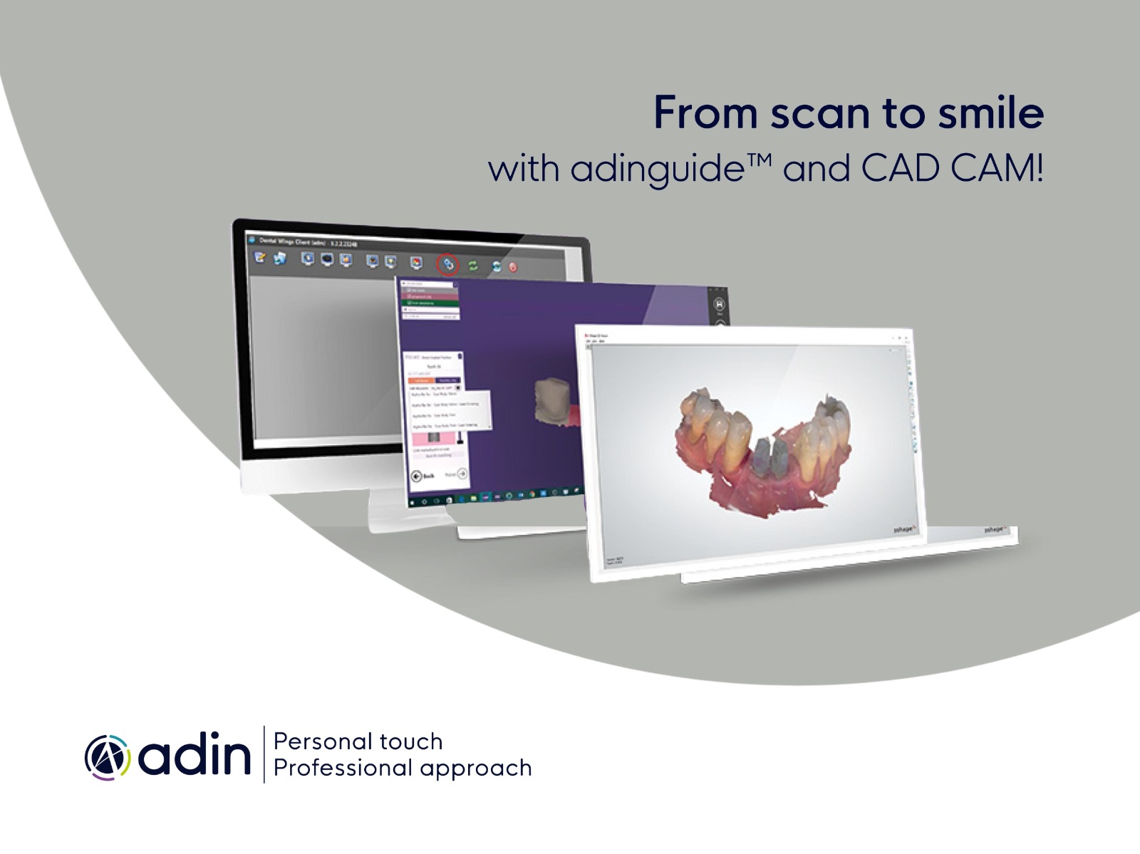 From scan to smile with adinguide™ and cad cam